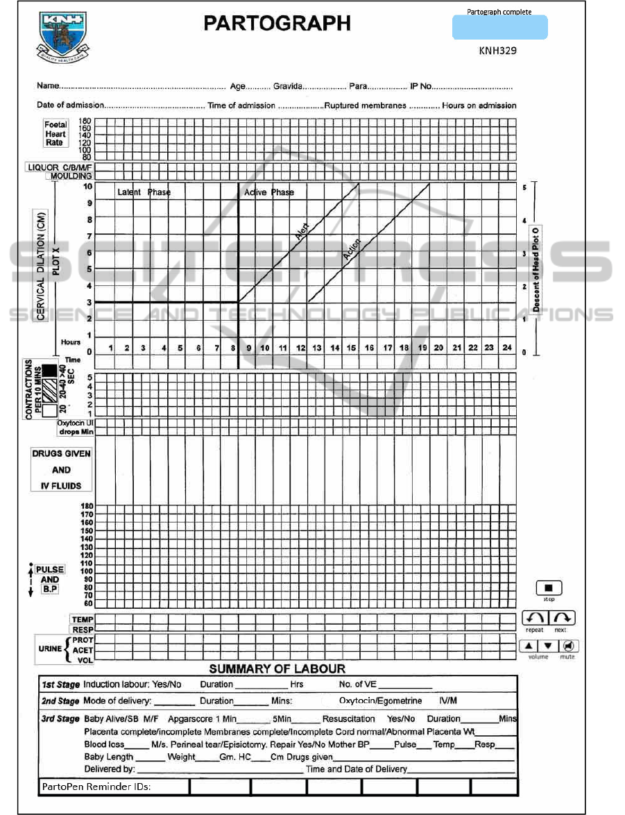 Partograph Chart Download